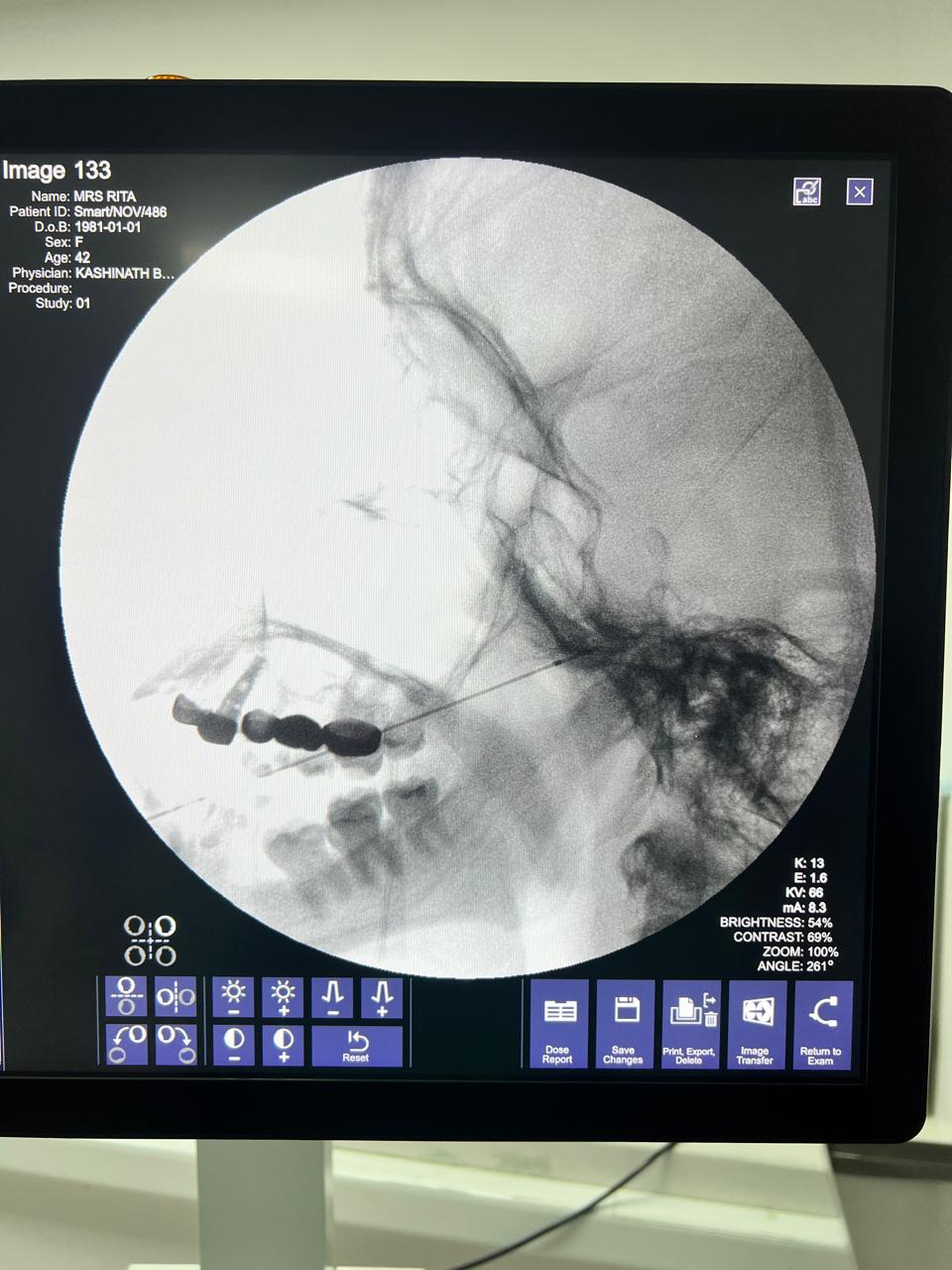Trigeminal Nerve Treatment The Painex Clinic Pune