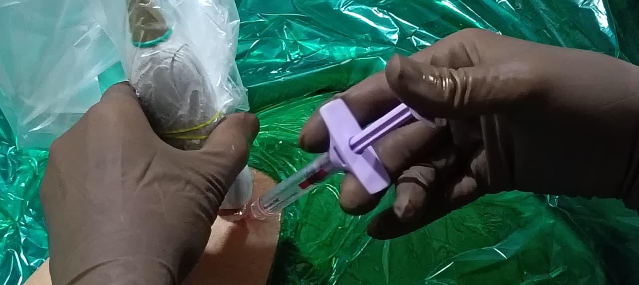 Knee Lubricant Injection for Osteoarthritis in Pune: From Pain to Movement