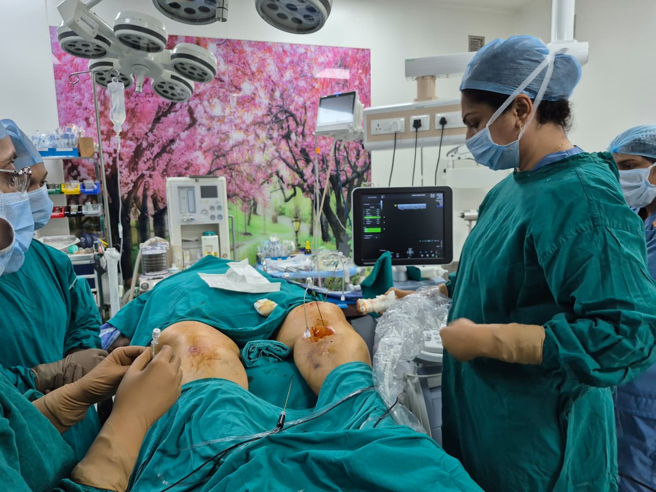 Patient receiving genicular nerve RFA under fluoroscopy guidance